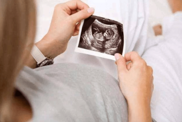 4个月和6个月时分别在私人诊所里检查了胎儿性别,两次都被告知是女孩