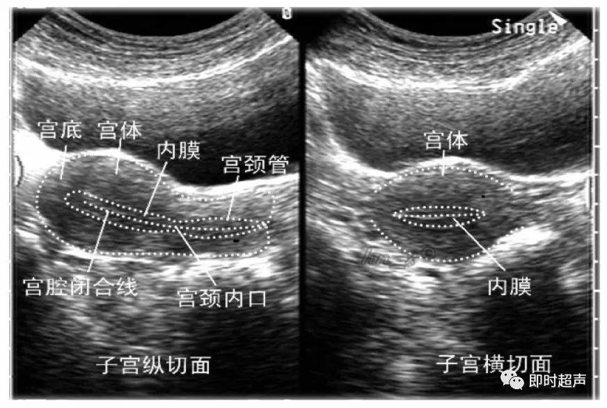 各时期女性生殖器官超声表现