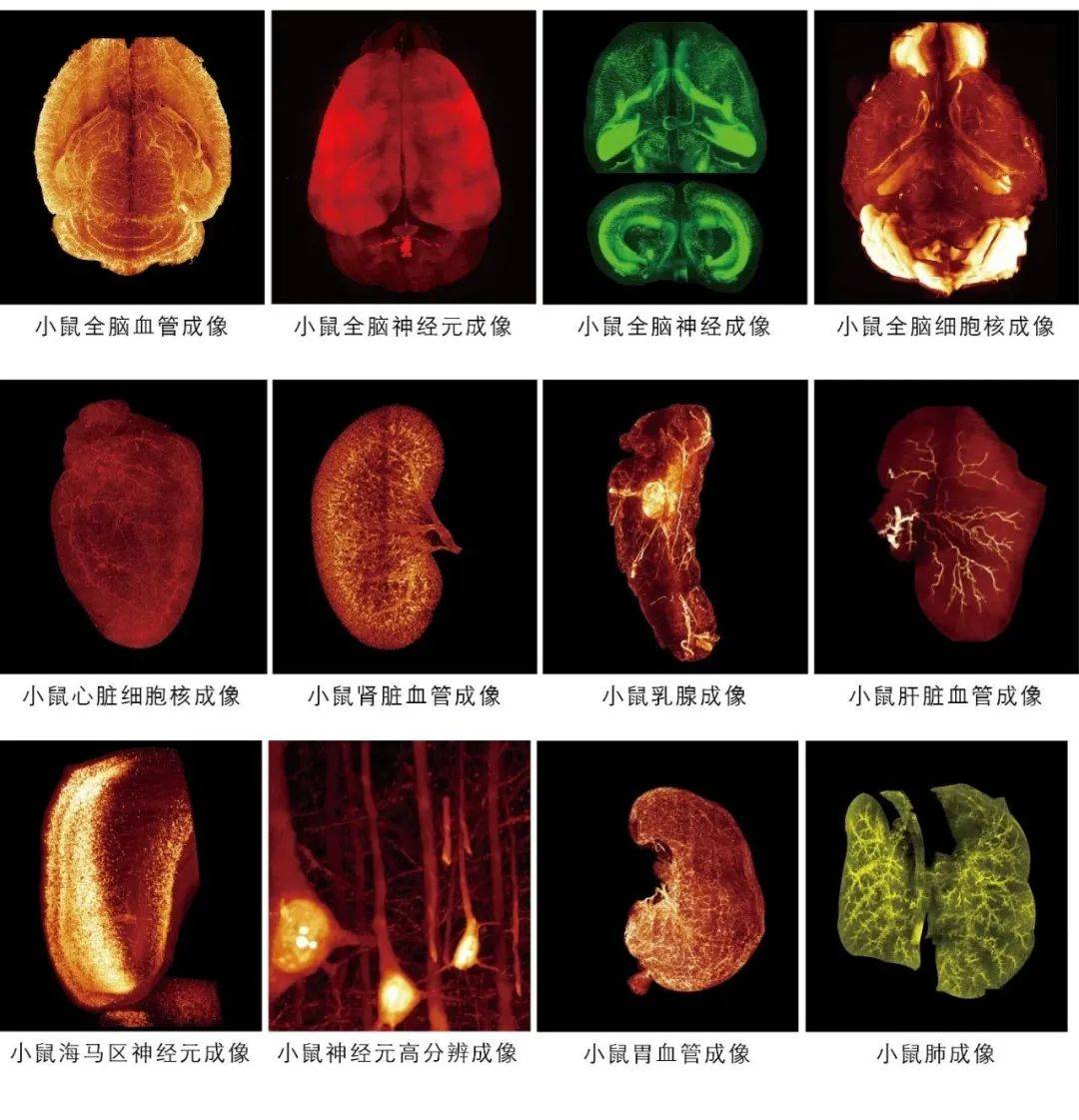 组织透明化染色,大组织3d荧光成像科研服务