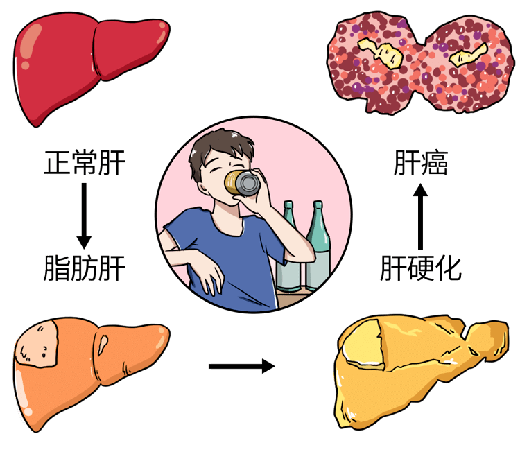 原创吴孟达从确诊肝癌到病逝不到3个月为何肝癌一发现就是晚期