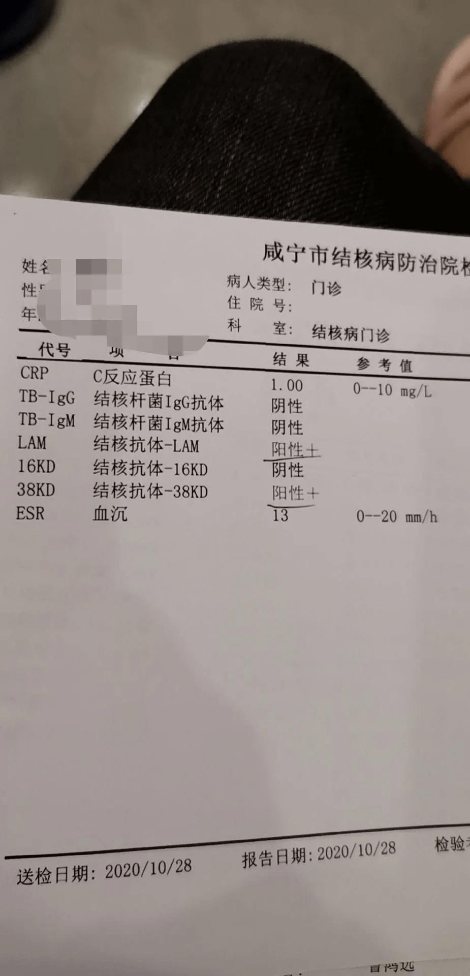 教育315|封闭培训后室友确诊肺结核,学员感染结核杆菌