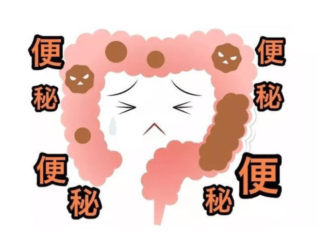 便秘为何越来越高发?提醒:3种食物吃太多,不利于肠道健康