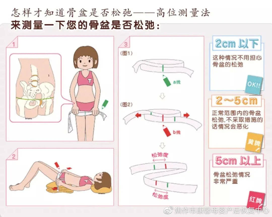 误区六盆底康复不就是缩肛运动吗?自己在家也可以做