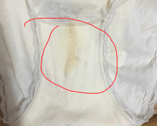 棕色的白带,而且数量也会变得很多,久了可能还洗不掉,污染到内裤
