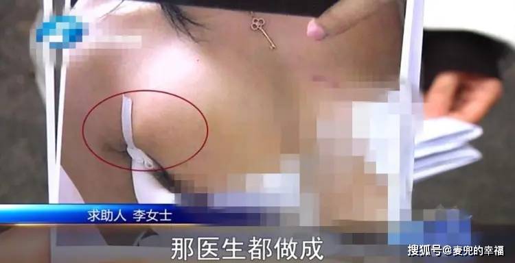 原创隆胸后胸部要切除,夫妻为此离了婚,女子割腕哭诉:都活不下去了