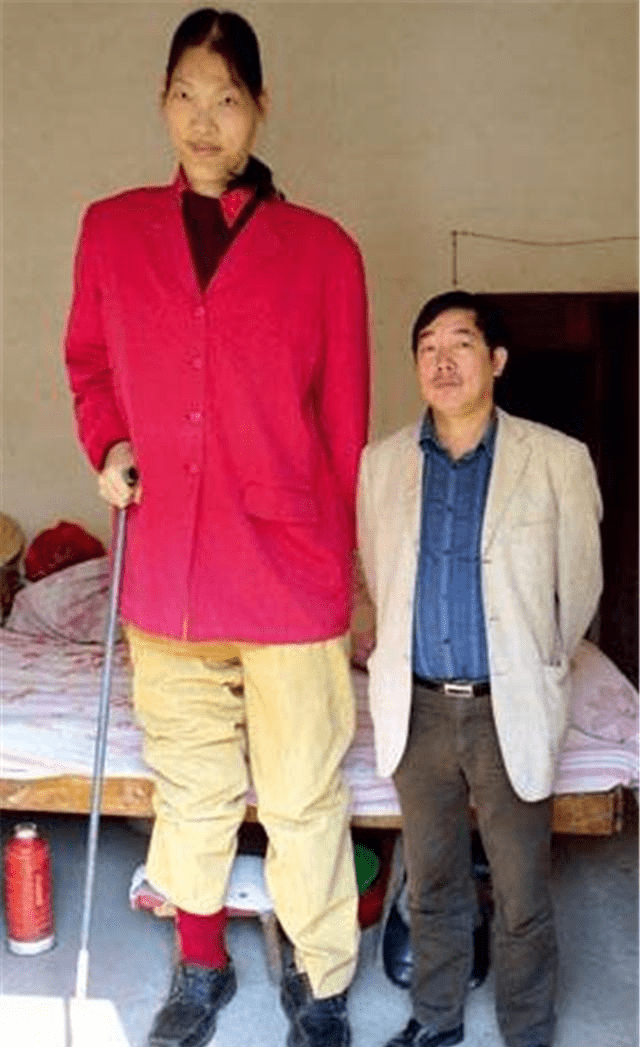 世界第一女巨人姚德芬,身高2.36米,41岁病逝