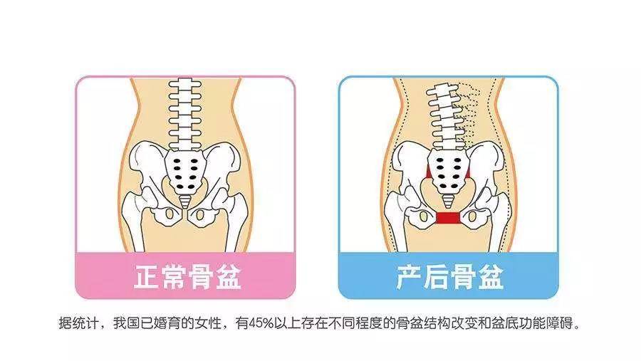 产后恢复是恢复什么,该如何恢复?