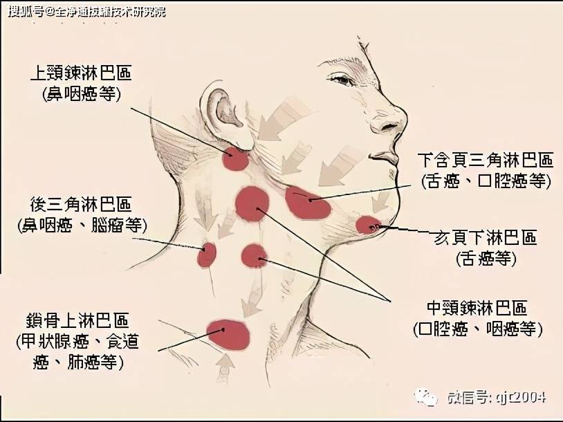 颈部淋巴,比较集中的部位分别是耳前耳后,腮边,下颌,颈身,后颈等.