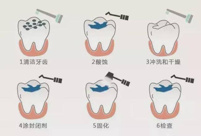 世界卫生日守好牙关赶紧来查收口腔健康保健攻略