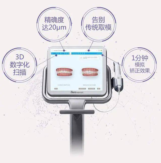 全省共10台惠安齿科6台的itero数字化口腔扫描仪好在哪里