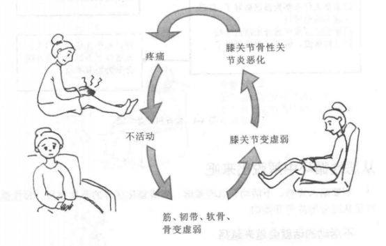 错!这4个动作对膝骨性关节炎的恢复很