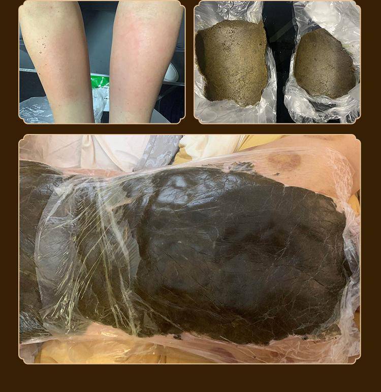 养生馆已经把热灸膏视为第一养生法宝