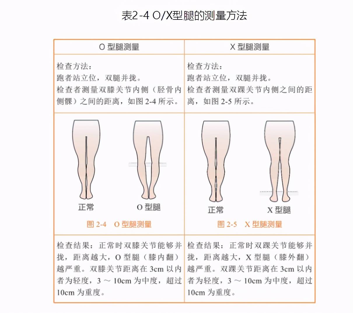 如何自己评估跑步的损伤风险?(2)_测量