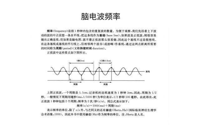 儿童脑电图基础与判读解析_波形