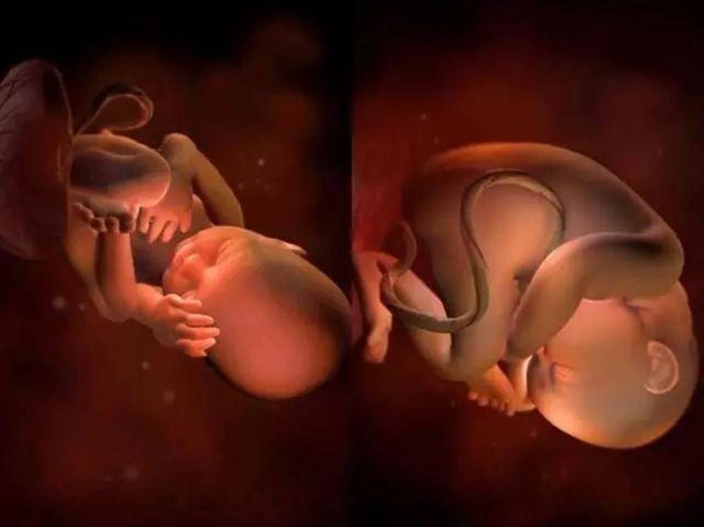 胎儿是否在预产期出生,和这个部位的发育有关,关系到宝宝存活率
