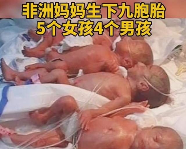非洲宝妈一举诞下9胞胎,5女4男,网友：＂产量＂让人望尘莫及