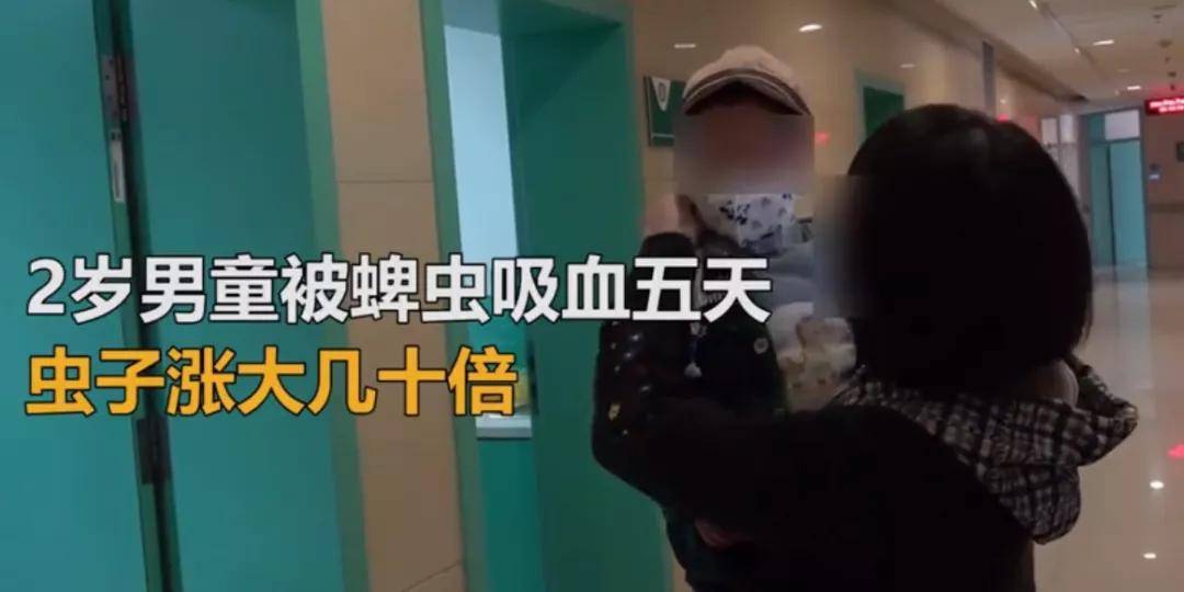 今年五一期间,辽宁一名2岁男童被蜱虫吸血五天,虫子涨大几十倍.