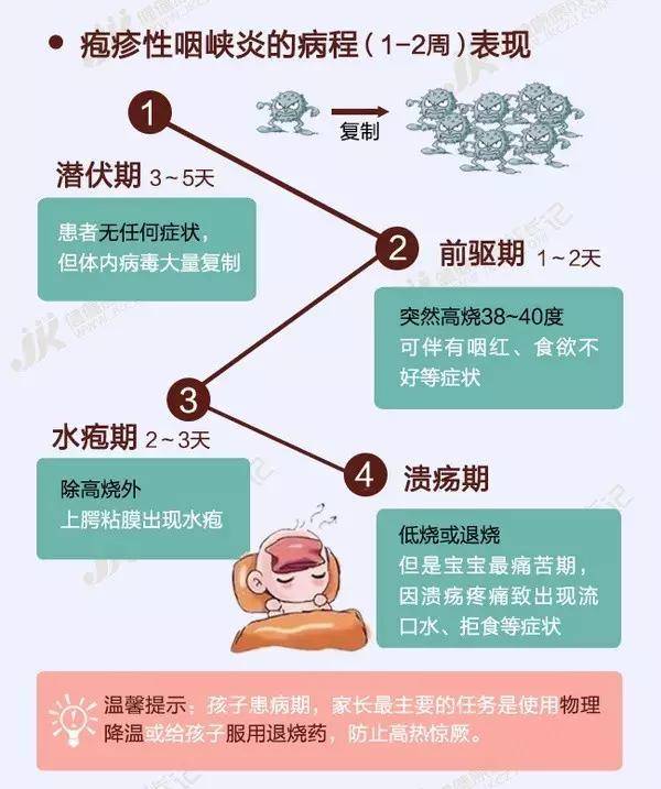 妈妈们可以先从一张图认识什么是疱疹性咽峡炎▼ 小儿