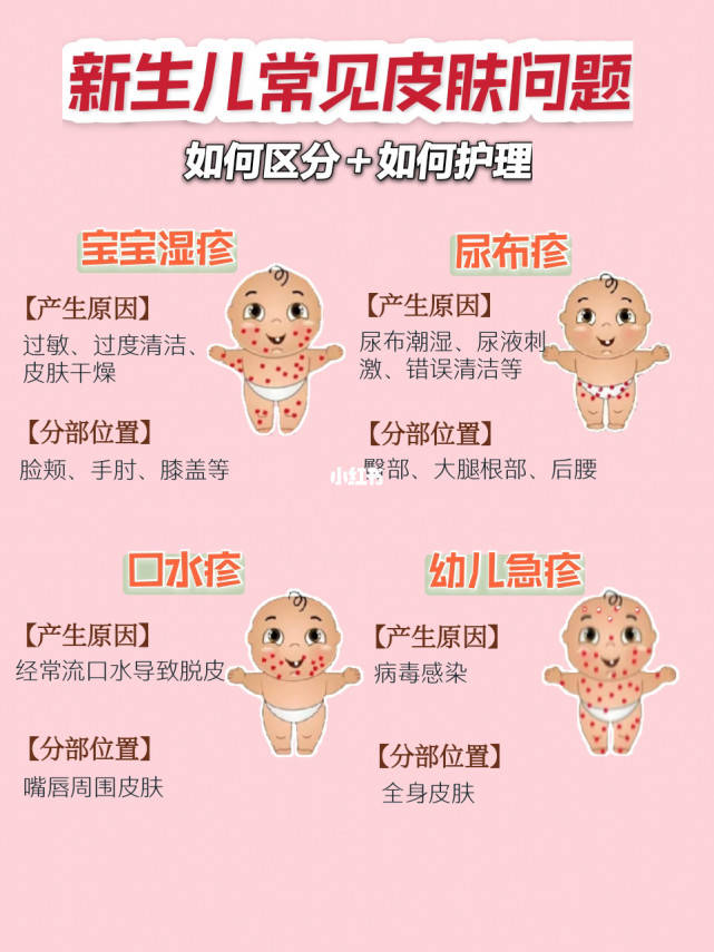 宝宝的口水疹要怎么护理才有效