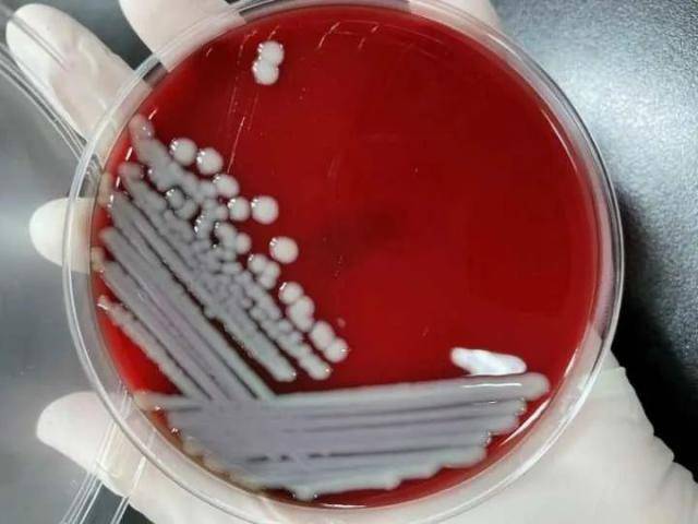 副溶血弧菌在血琼脂平板上的菌落特性