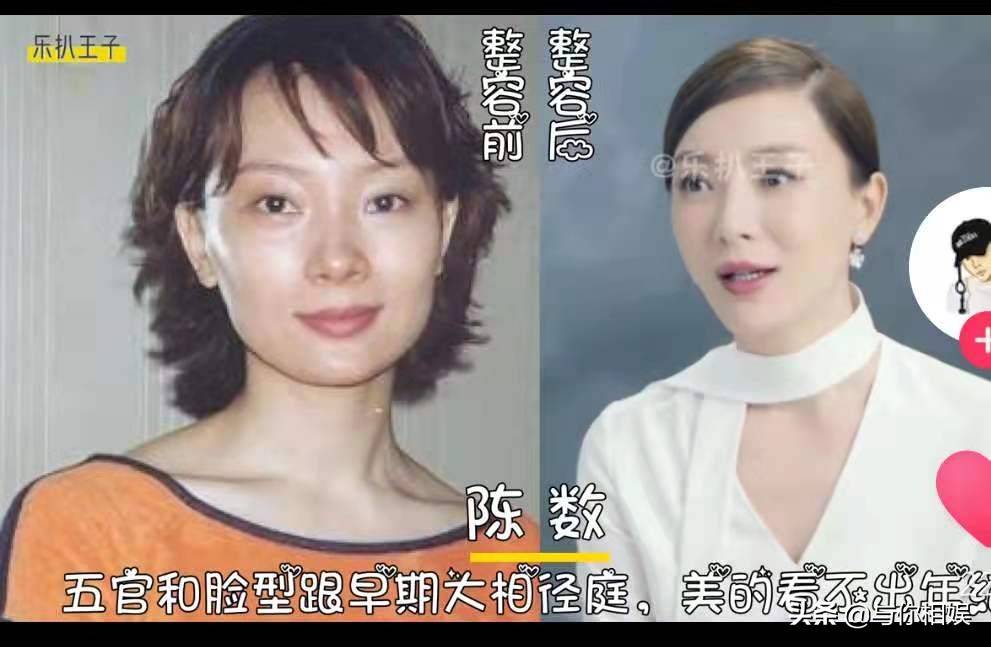 女明星整容前后大对比,整容后的她们星途都怎么样了呢