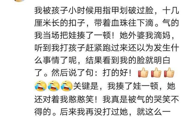 "坐头发,压肚子,打下巴各种经历过,鞋子被踩烂,裤子大腿全是脚印"