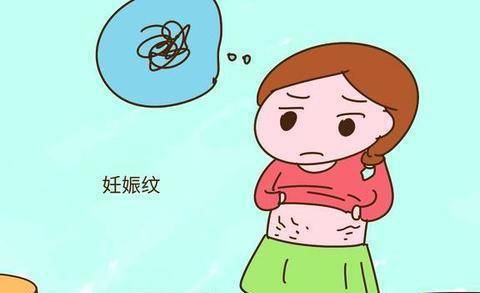 孕期,妊娠纹什么时候开始预防?如何有效预防?警惕妊娠