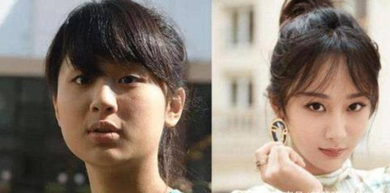 女星出道前照片被扒杨紫杨幂朴素看到鞠婧祎医生来一下