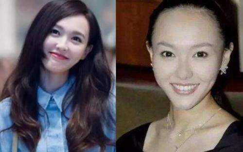 女明星掀刘海:杨幂发际线后移严重,沈梦辰大脑门,lisa