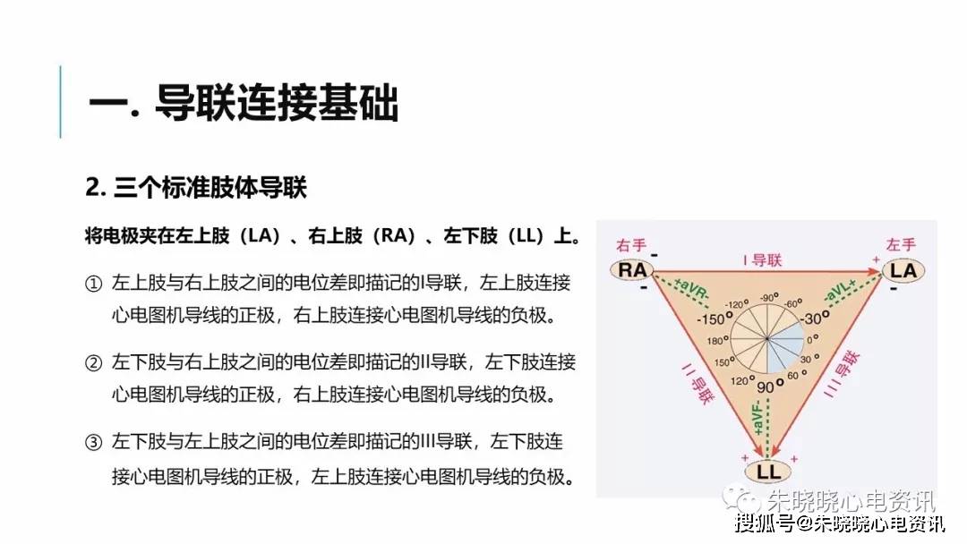 肢体导联电极错接心电图分析及鉴别ppt