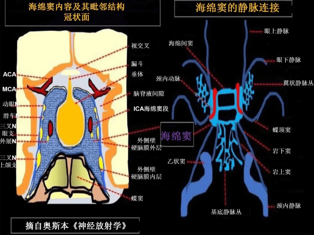 详细的海绵窦疾病总结