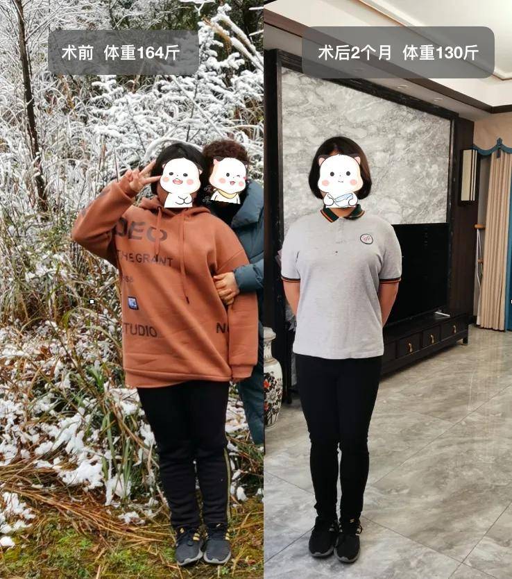 2个月瘦34斤15岁女孩的漫漫减重路