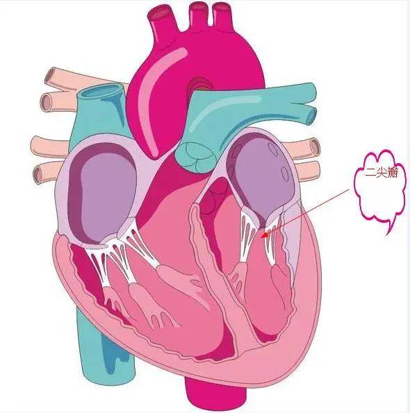 二尖瓣反流是什么病?要不要治疗?看完你就懂了!