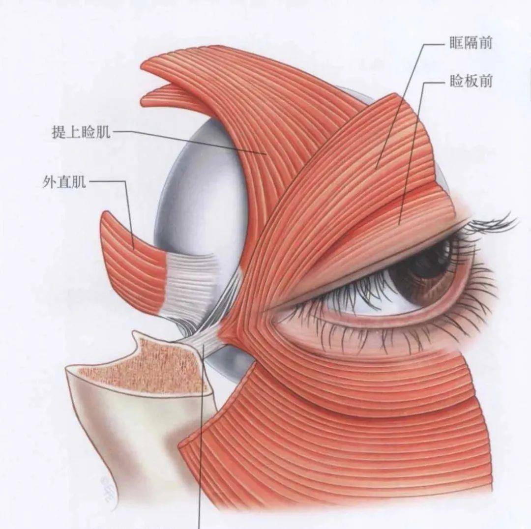 将睑板或外眦下支持韧带悬吊于眶骨,以达到提紧和复位下眼睑的目的