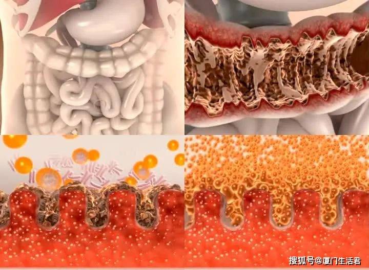 你的肠道堆积了6.5kg垃圾待清理!_毒素
