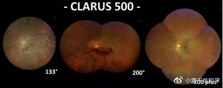 赞蔡司clarus500高清超广角眼底相机落户深圳爱尔眼科