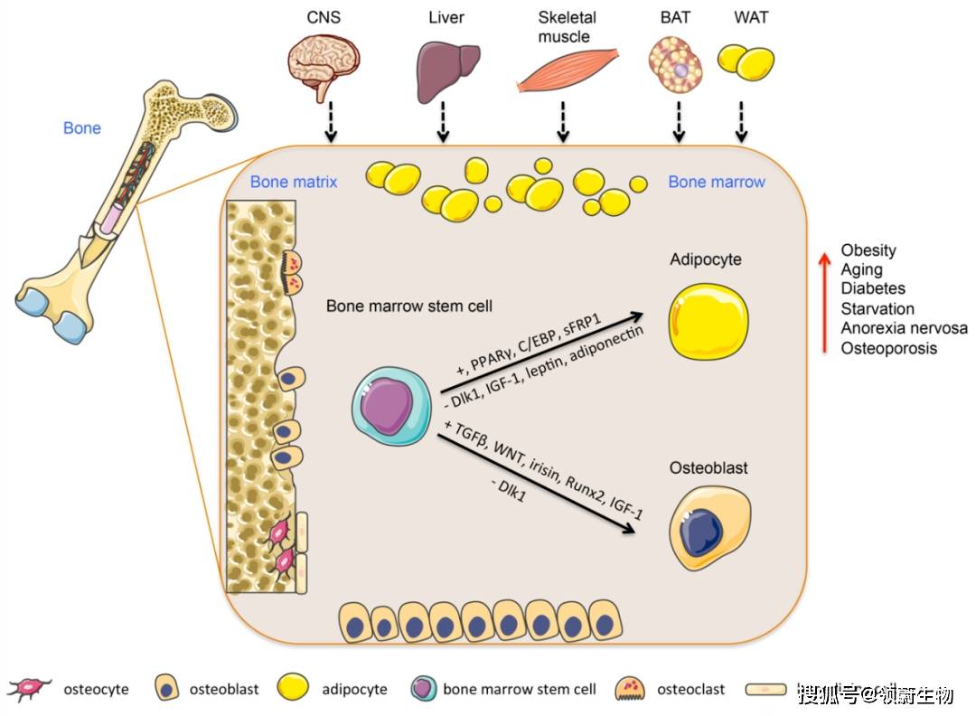 小心了,肥胖通过骨髓间充质干细胞影响到骨骼健康