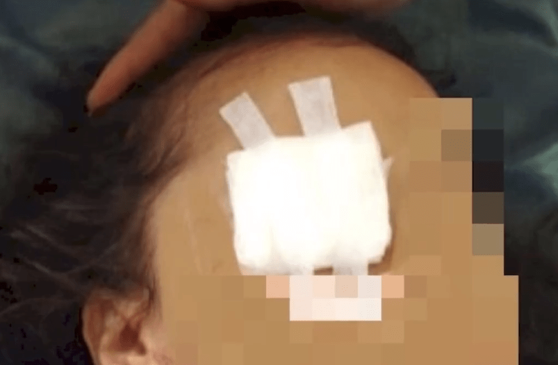 印度6岁女孩被父母抠出眼球,声称:食人可获得力量