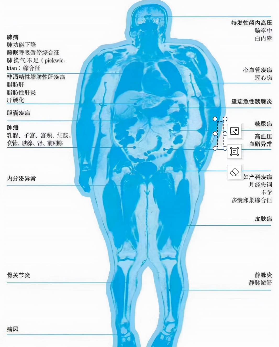 【孕妇必看】孕期到底要增重多少才合理？快来对照一下你超标没