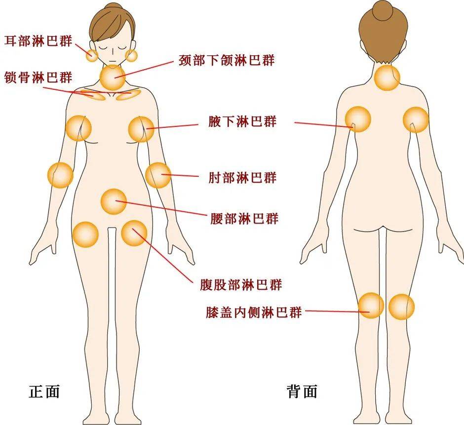 易造成上肢手臂偏胖,粗 4.千万不要认为腋下淋巴颜色偏黑,有