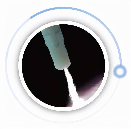 氩离子凝固术在手术中的应用