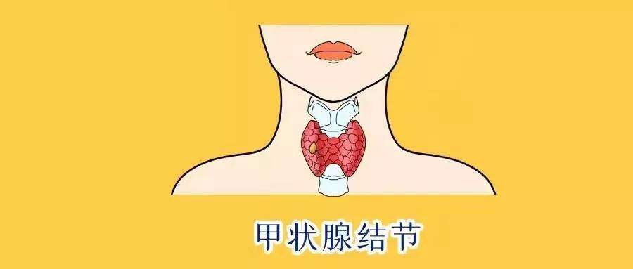 濮阳市人民医院射频消融术甲状腺瘤患者的福音