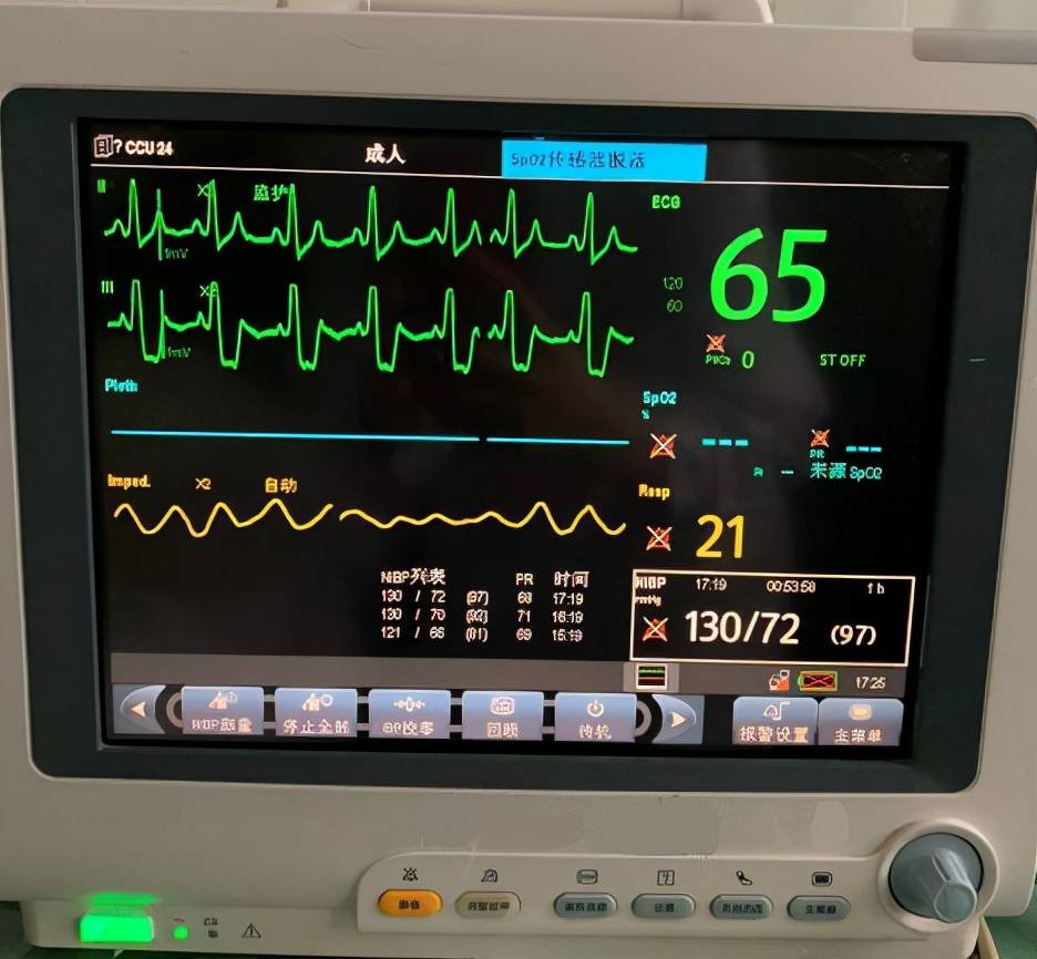 心电监护仪的应用从四个特点详细剖析有没有收藏价值看完便知