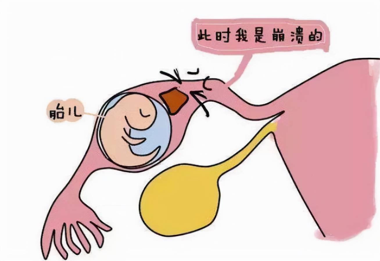 老人常说＂十男九红＂,孕早期见红是怀男孩的标志？孕妈别糊涂