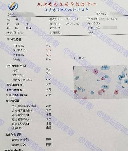 妇科检查中的tct显示不典型鳞状细胞是怎么回事为何需活检