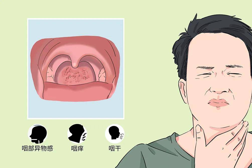 听说久不治愈的慢性咽炎有癌变的可能这是真的吗