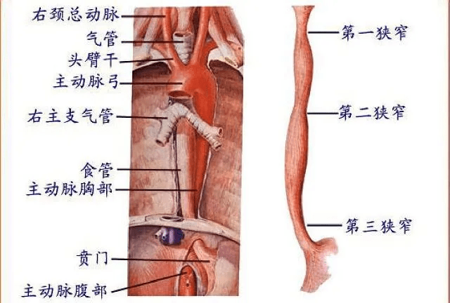 异物通常卡在食管的三个狭窄处:第一狭窄处最多,位于食道入口处;第二