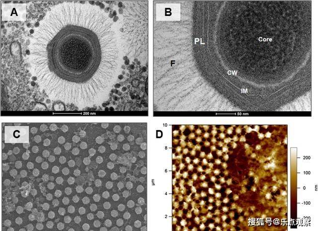 在他们题为《变形虫中的巨型病毒》的论文中,他们描述了一种400纳米的