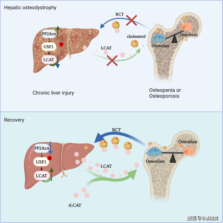 筛选出关键的肝骨轴调节分子lcat,明确了胆固醇逆向转运对于维持肝脏