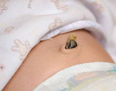 肚脐内的"泥"能够抠吗?正确答案:能够,只是要注意方法_清理_进行_情况